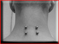 Piercing de surface "double nuque",  fait  relief tattoo  Valenciennes